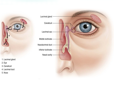 After DCR Surgery