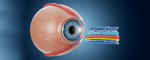 Creating the Lenticule